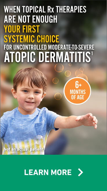When Topical Rx Therapies Are Not Enough Your First Systemic Choice for Uncontrolled Moderate-to-Severe Atopic Dermatitis